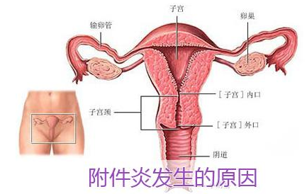 诊断附件炎到邹城哪家医院